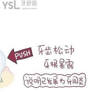 為什么總是感覺牙齒有點松動？懂的人來說說