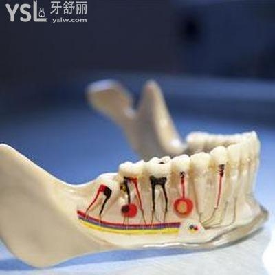 牙齒神經(jīng)痛會(huì)自動(dòng)痊愈嗎？