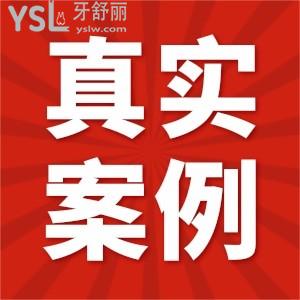 去無(wú)錫維樂(lè)口腔門診部看牙是怎樣的體驗(yàn)？真實(shí)評(píng)價(jià)在這里