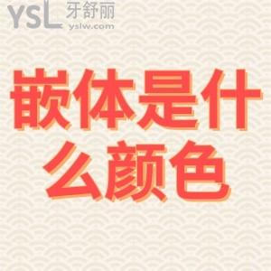 嵌體修復(fù)是什么顏色？