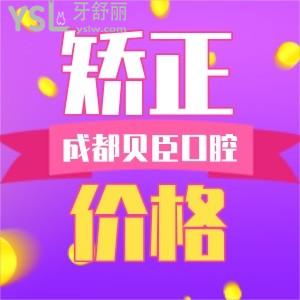 成都錦江貝臣口腔牙齒矯正價(jià)格到底貴不貴 從各方面中可以得知