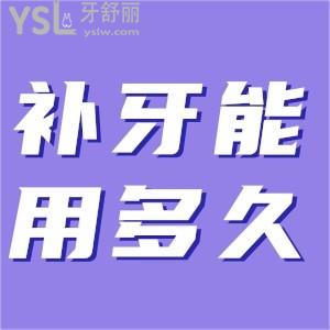 補一次牙能維持多久？