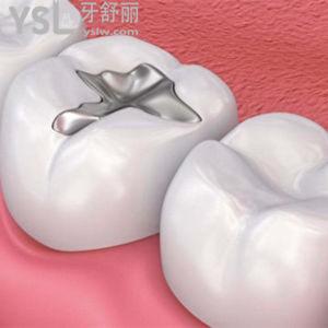 補(bǔ)牙用什么材料較好最牢固？