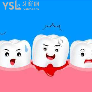 牙周炎和牙齦炎一樣嗎 怎么區(qū)別？