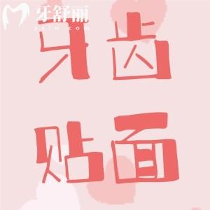 牙齒貼面