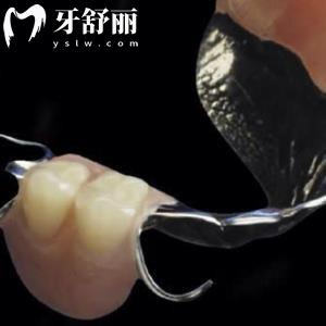 純鈦支架義齒