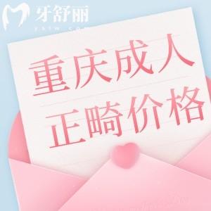重慶成人牙齒正畸多少錢?價(jià)格1-4萬還有技術(shù)好醫(yī)院排名前十分享