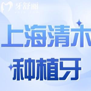 上海清木口腔種植牙怎么樣?品牌質(zhì)量好服務(wù)技術(shù)優(yōu)還不貴