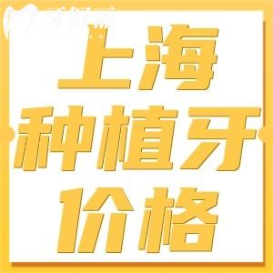 上海種植牙價(jià)格一般一顆多少錢?2024全新價(jià)格表含半口/全口種牙費(fèi)用