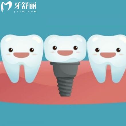 2024新版株洲口腔醫(yī)院種植牙價(jià)格表全,get種植牙比較好的牙科醫(yī)院多少錢(qián)一顆