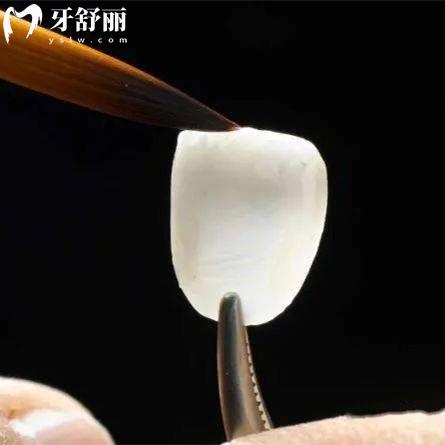 更新資陽牙科醫(yī)院收費標(biāo)準(zhǔn)表：種植牙3000+矯正5800補牙/拔牙價格實惠