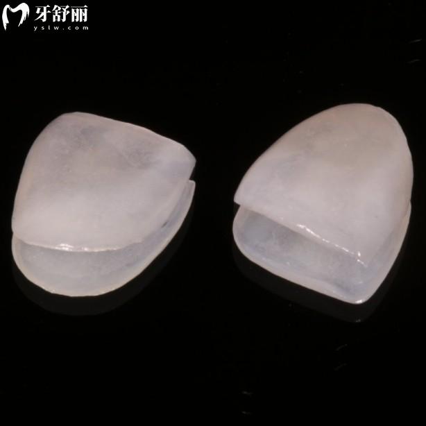 義獲嘉藍(lán)瓷貼面