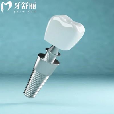 美國(guó)必適佳Biotanium種植體