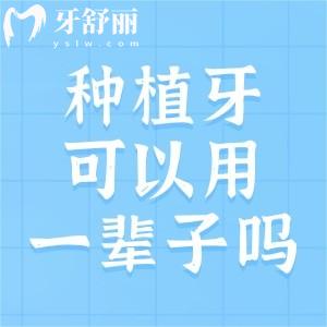 做種植牙真的可以用一輩子嗎