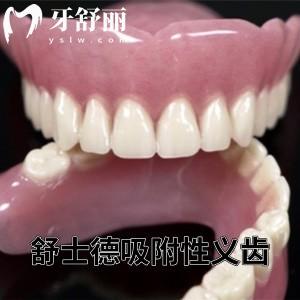 舒士德吸附性義齒