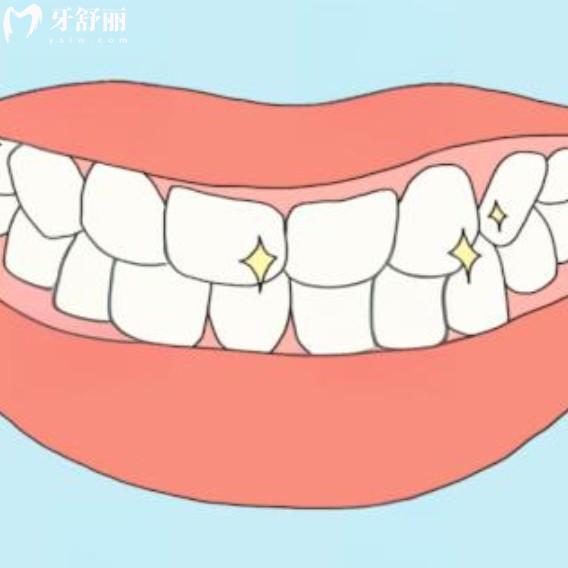 30歲做了滿口烤瓷牙能用一輩子嗎？老了還能用嗎？