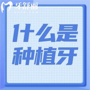 什么是種植牙?有哪些優(yōu)缺點?