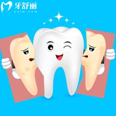 牙齒美白的方法哪種有效？是不是智商稅？