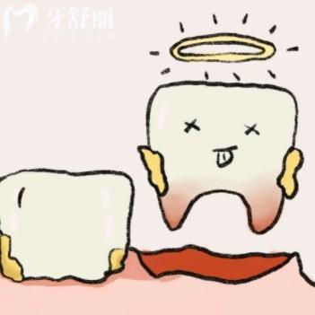 先洗牙還是先拔牙補(bǔ)牙？