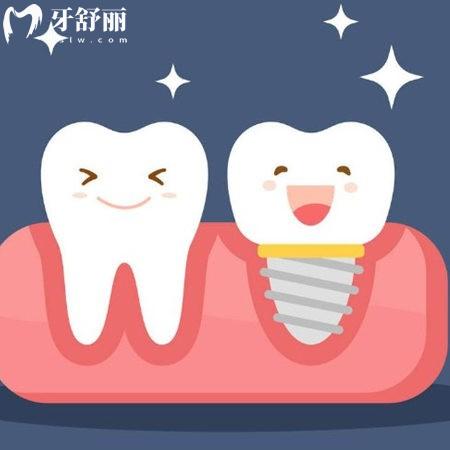 西寧市種牙價(jià)格表新版2025:參考中諾2680+諾貝爾2800+非凡1880+
