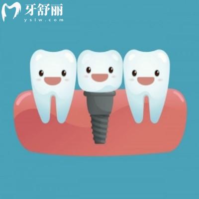 2025鄭州二七區(qū)口腔醫(yī)院價格表:含種植牙/牙齒矯正點擊查看收費標準