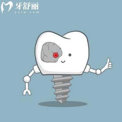 廣州廣大口腔醫(yī)院免費(fèi)種牙是真的嗎,瞧超雞凍500顆進(jìn)口種植牙免費(fèi)種不騙人