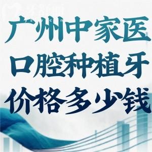 ?我嘞個(gè)豆!廣州中家醫(yī)口腔種植牙298元是真的!詳細(xì)種牙價(jià)格表看過(guò)絕不錯(cuò)過(guò)
