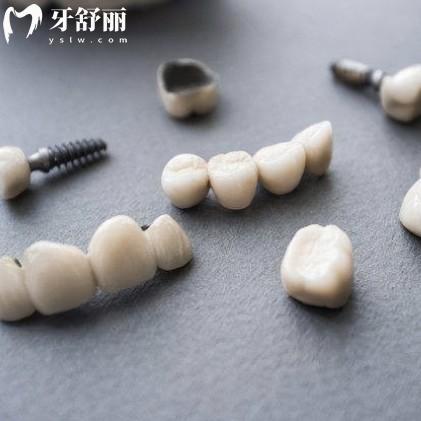 烤瓷牙多少錢一顆價格表2025，鎳鉻400+鈷鉻800+鈦合金1500+