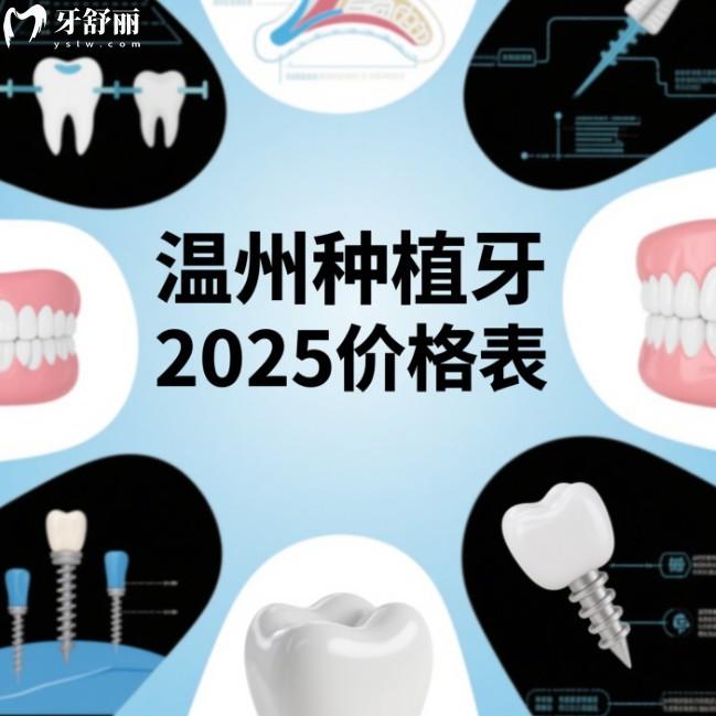 溫州種植牙2025價(jià)格表:在線查詢溫州單顆/半口/全口種植牙多少錢