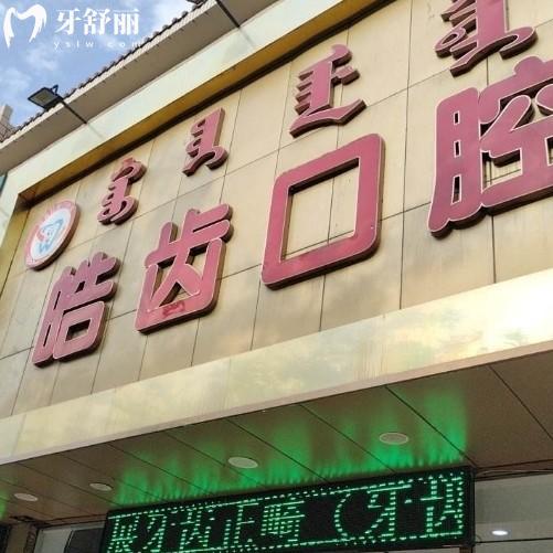 烏海皓齒口腔洗一次牙多少錢？80元起還有補牙種牙報價