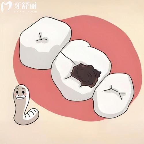 東莞比較出名的牙科醫(yī)院排名:莞大/好佰年/國貿(mào)/固德收費(fèi)不貴技術(shù)賊好