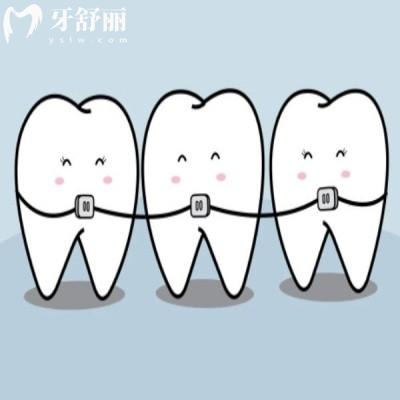 蘇州牙齒矯正哪個(gè)醫(yī)院好?上榜的這五家口腔醫(yī)院矯正技術(shù)口碑都不錯(cuò)