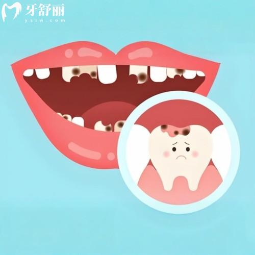 2025成都牙科排名前十的醫(yī)院有哪些?收好這份成都牙科十大口腔醫(yī)院排名榜單